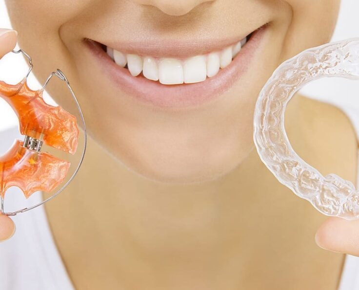 retainer