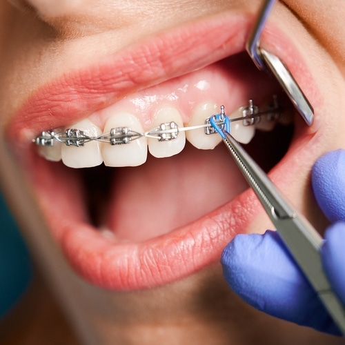 Orthodontist near New Hyde Park, NY
