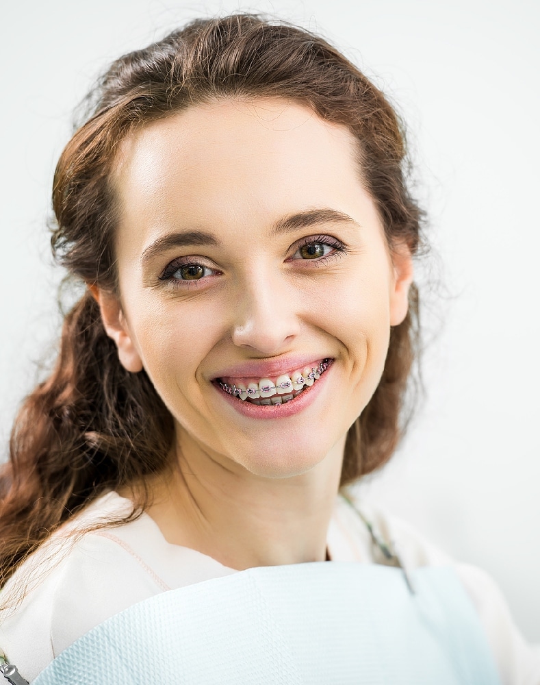 Braces for adults