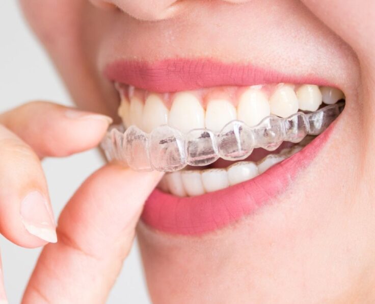Invisalign Treatment in West Hempstead