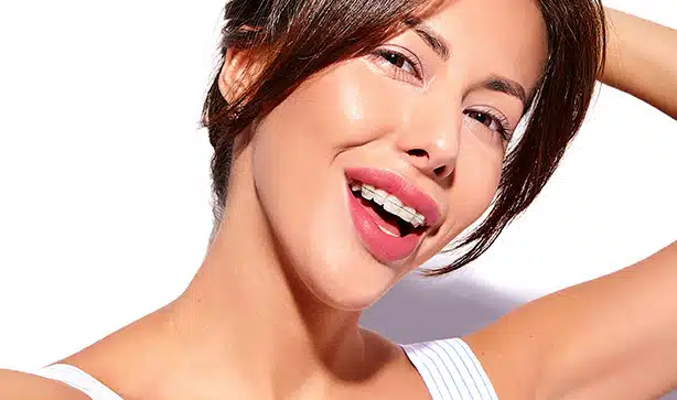 Types of lightforce braces