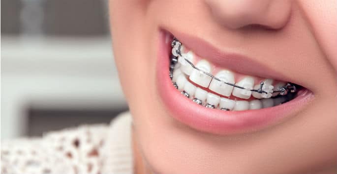 Orthodontic Care for West Hempstead