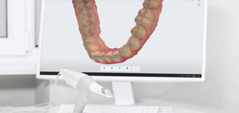 iTero Scanner in West Hempstead for Digital Smile Design