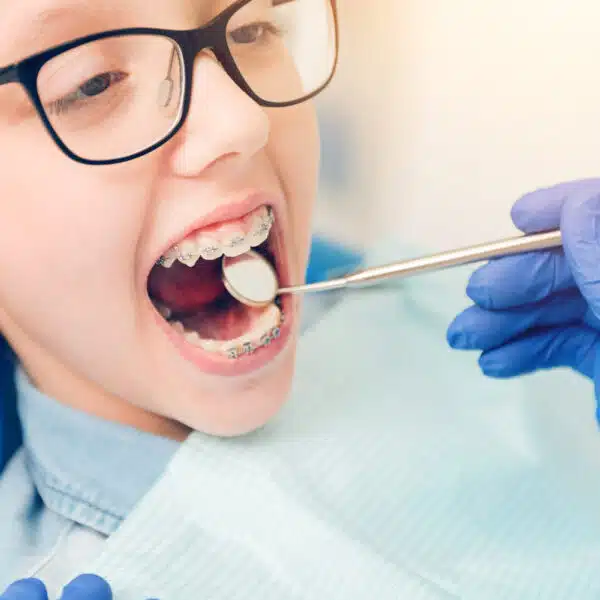 Child Orthodontic Treatment