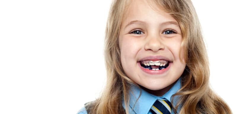 Child smiling during Phase 1 treatment West Hempstead