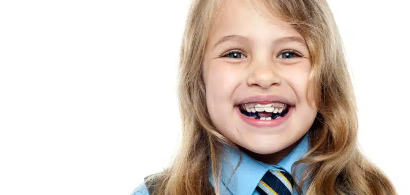 Child smiling during Phase 1 treatment West Hempstead